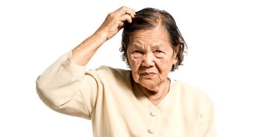 As etapas do Alzheimer